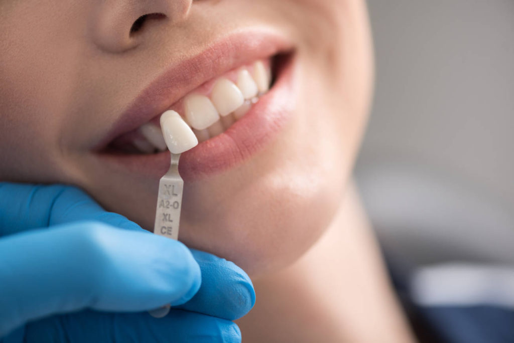 ¿Cuáles son los tipos de cirugía bucal más comunes?