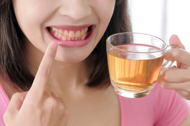 Cuidado con los alimentos que pueden teñir tus dientes