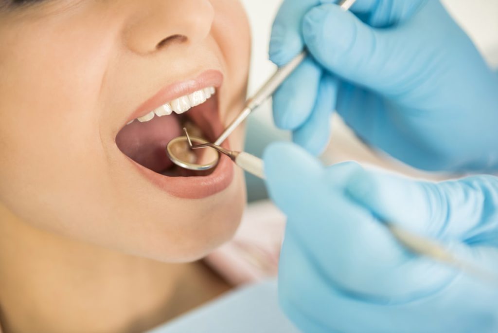 ¿En qué consiste la endodoncia?
