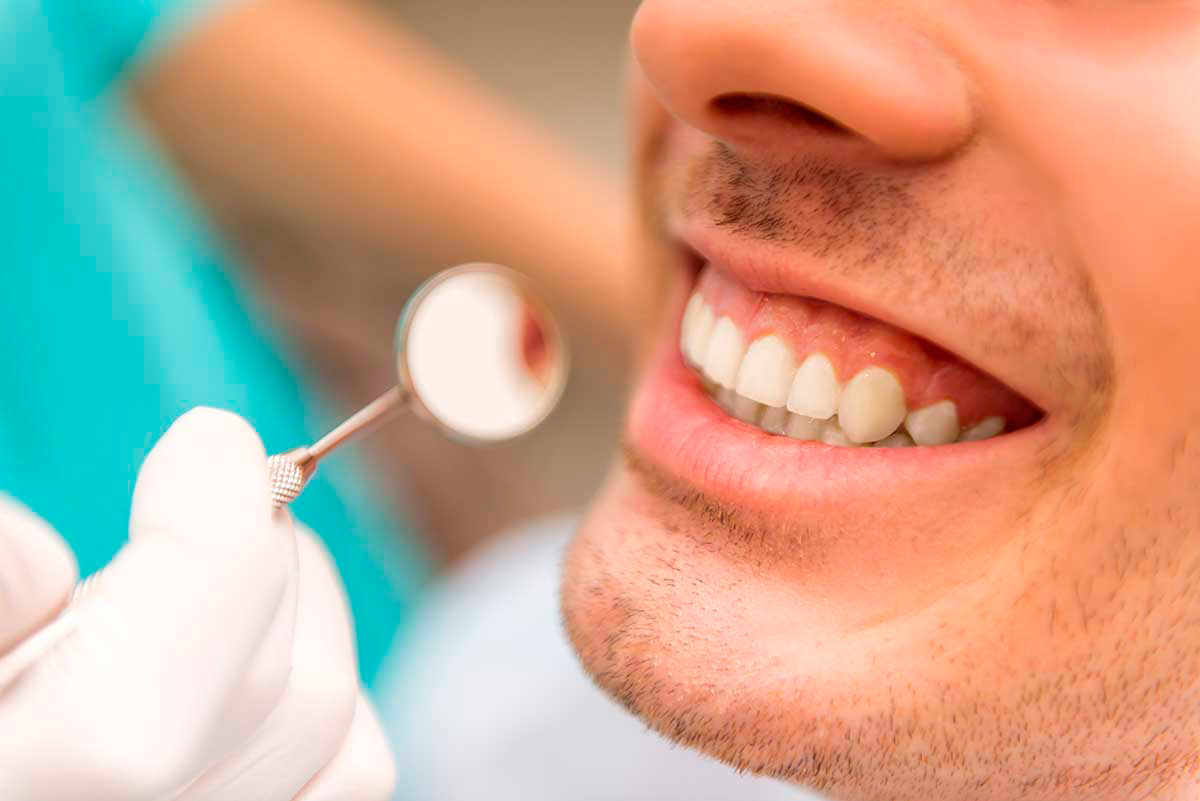 Todo lo que necesitas saber sobre la placa dental