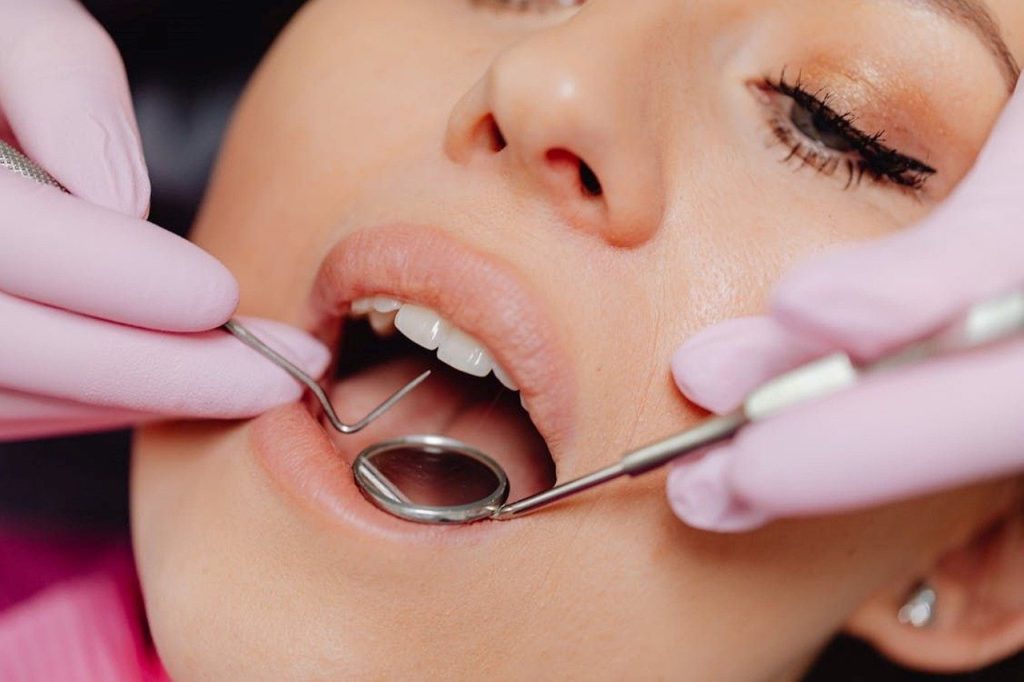 Importancia de las revisiones dentales